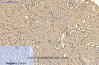 Immunohistochemistry of paraffin-embedded Rat kidney tissue using ACTA2 Monoclonal Antibody at dilution of 1:200.