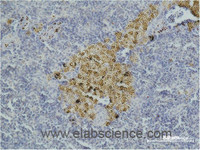 Immunohistochemistry of paraffin-embedded Mouse spleen tissue with CASP8 Monoclonal Antibody