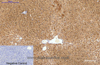 Immunohistochemistry of paraffin-embedded Human liver tissue using HAO1 Monoclonal Antibody at dilution of 1:200.