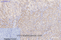 Immunohistochemistry of paraffin-embedded Mouse kidney tissue using Catenin beta Monoclonal Antibody at dilution of 1:200.