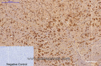 Immunohistochemistry of paraffin-embedded Mouse brain tissue using Survivin Monoclonal Antibody at dilution of 1:200.