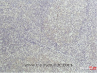 Immunohistochemical analysis of paraffin-embedded Human tonsil tissue using TNF alpha Monoclonal Antibody at dilution of 1:50.
