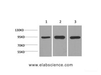 Western Blot analysis of 1) Hela, 2) Mouse brain, 3) Rat brain using HSP90 alpha Monoclonal Antibody at dilution of 1:2000.