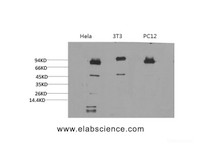 Western Blot analysis of 1) Hela, 2) 3T3, 3) PC-12 cells using STAT3 Monoclonal Antibody at dilution of 1:2000.