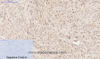 Immunohistochemistry of paraffin-embedded Human uterus tissue using PPIB Monoclonal Antibody at dilution of 1:200.