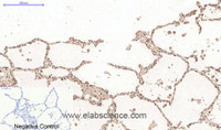 Immunohistochemistry of paraffin-embedded Human lung tissue using Desmin Monoclonal Antibody at dilution of 1:200.