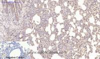 Immunohistochemistry of paraffin-embedded Mouse lung tissue using Desmin Monoclonal Antibody at dilution of 1:200.