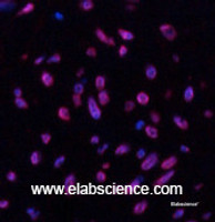 Immunofluorescence analysis of Human uterus tissue using Desmin Monoclonal Antibody at dilution of 1:200.
