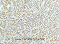 Immunohistochemistry of paraffin-embedded Human kidney tissue using ACTN1 Monoclonal Antibody at dilution of 1:200.