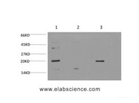 Western Blot analysis of 1) Hela, 2) C2C12, 3) PC-12 cells using Bax Monoclonal Antibody at dilution of 1:1000.