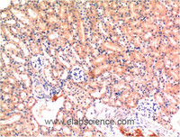 Immunohistochemistry of paraffin-embedded Mouse kidney tissue using Bax Monoclonal Antibody at dilution of 1:200.
