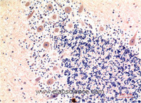 Immunohistochemistry of paraffin-embedded Human brain tissue using MAP1LC3B Monoclonal Antibody at dilution of 1:200.