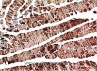 Immunohistochemistry of paraffin-embedded Mouse skeletal muscle tissue using ACTA1 Monoclonal Antibody at dilution of 1:200.