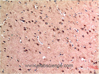 Immunohistochemistry of paraffin-embedded Human brain tissue using BECN1 Monoclonal Antibody at dilution of 1:200.