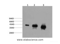 Western Blot analysis of 1) Hela, 2) Mouse brain, 3) Rat brain using ERK 1/2 Monoclonal Antibody at dilution of 1:2000.