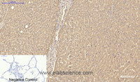 Immunohistochemistry of paraffin-embedded Human lung tissue using TTR Monoclonal Antibody at dilution of 1:200.