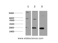 Western Blot analysis of 1) Hela, 2) 3T3, 3) PC-12 cells using CBX3 Monoclonal Antibody at dilution of 1:1000.