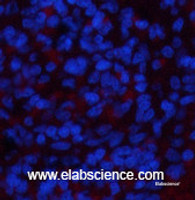 Immunofluorescence analysis of Rat spleen tissue using NBR1 Monoclonal Antibody at dilution of 1:200.