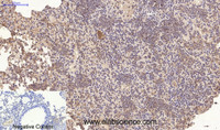Immunohistochemistry of paraffin-embedded Mouse lung tissue using CD10 Monoclonal Antibody at dilution of 1:200.