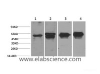 Western Blot analysis of 1) Hela, 2) 293T, 3) Mouse brain, 4) Rat brain using c-Fos Monoclonal Antibody at dilution of 1:2000.