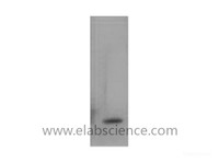 Western Blot analysis of Recombinant Human TNF a Protein using TNF alpha Monoclonal Antibody at dilution of 1:2000.