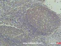 Immunohistochemistry of paraffin-embedded Human tonsil tissue using TNF alpha Monoclonal Antibody at dilution of 1:50.