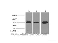 Western Blot analysis of 1) Hela, 2) 3T3, 3) Rat brain using MAP2K2 Monoclonal Antibody at dilution of 1:2000.