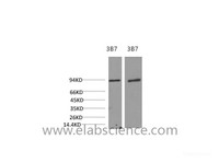 Western Blot analysis of 1) 3T3, 2) Rat liver using PI 3 kinase p85 alpha Monoclonal Antibody at dilution of 1:2000.