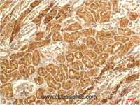 Immunohistochemistry of paraffin-embedded Human kidney tissue using IL8 Monoclonal Antibody at dilution of 1:200.