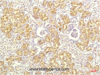 Immunohistochemistry of paraffin-embedded Human kidney tissue using IL8 Monoclonal Antibody at dilution of 1:200.