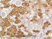 Immunohistochemistry of paraffin-embedded Human kidney tissue using IL8 Monoclonal Antibody at dilution of 1:200.