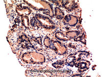 Immunohistochemistry of paraffin-embedded Human prostate tissue using CASP3 Monoclonal Antibody at dilution of 1:200.