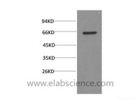 Western Blot analysis of PC3 cells using AKT1 Monoclonal Antibody at dilution of 1:2000.