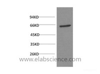 Western Blot analysis of PC3 cells using AKT1 Monoclonal Antibody at dilution of 1:1000.