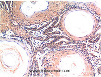 Immunohistochemistry of paraffin-embedded Human skin tissue using CASP3 Monoclonal Antibody at dilution of 1:200.