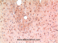 Immunohistochemistry of paraffin-embedded Rat brain tissue using TGFB1 Monoclonal Antibody at dilution of 1:200.