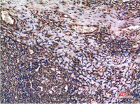 Immunohistochemistry of paraffin-embedded Human tonsil tissue using Cyclin B1 Monoclonal Antibody at dilution of 1:200.