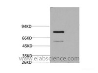 Western Blot analysis of Firefly Luciferase Transfected Hela using Luciferase Monoclonal Antibody at dilution of 1:2000.