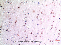 Immunohistochemistry of paraffin-embedded Human brain tissue using BECN1 Monoclonal Antibody at dilution of 1:200.