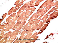 Immunohistochemistry of paraffin-embedded Human skeletal muscle tissue using AMPK alpha1 Monoclonal Antibody at dilution of 1:200.