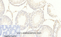 Immunohistochemistry of paraffin-embedded Rat testis tissue using Phospho-FOXO3 (Ser253) Polyclonal Antibody at dilution of 1:200
