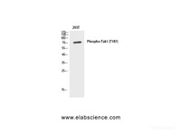 Western Blot analysis of 293T cells using Phospho-MAP3K7 (Thr187) Polyclonal Antibody at dilution of 1:1000