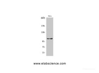 Western Blot analysis of Hela cells with Phospho-eEF2K (Ser366) Polyclonal Antibody at dilution of 1:1000