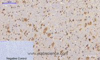 Immunohistochemistry of paraffin-embedded Mouse brain tissue with Phospho-FAK (Tyr397) Polyclonal Antibody at dilution of 1:200
