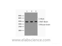 Western Blot analysis of Hela (1) Rat brain (2) Mouse brain (3) using beta actin Monoclonal Antibody at dilution of 1:10000.