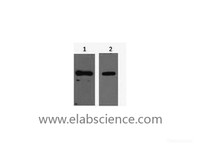 Western Blot analysis of 1) His-Tag transfected 293T, 2) His-MBP recombinant protein using His-Tag Monoclonal Antibody at dilution of 1:5000.