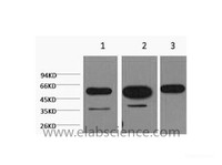 Western Blot analysis of 1) Hela, 2) Mouse brain, 3) Rat brain using beta Tubulin Monoclonal Antibody at dilution of 1:5000.