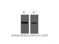 Western Blot analysis of 1) His-MBP recombinant protein, 2) His-Tag transfected 293T using His-Tag Monoclonal Antibody at dilution of 1:10000.