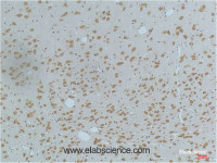 Immunohistochemistry of paraffin-embedded Rat brain tissue using Phospho-CAMK2 beta/gamma/delta (Thr287) Monoclonal Antibody at dilution of 1:200.