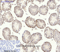 Immunohistochemistry of paraffin-embedded Mouse testis tissue using AMPK alpha1/2 Polyclonal Antibody at dilution of 1:200.